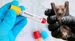 Kuwait confirms no Marburg virus in the country